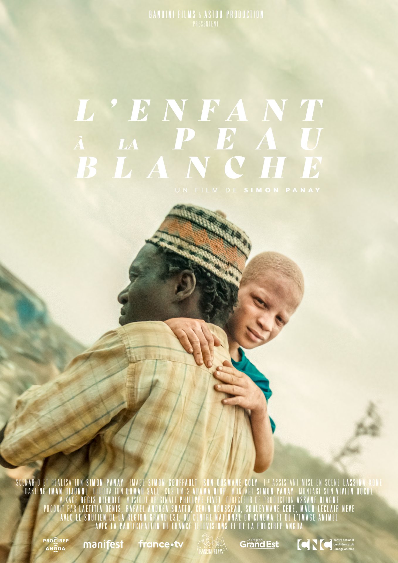 enfant-a-la-peau-blanche